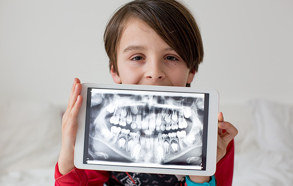 Amarillo Super Smiles For Kids | Sports Mouthguards, Clear Braces and Emergencies