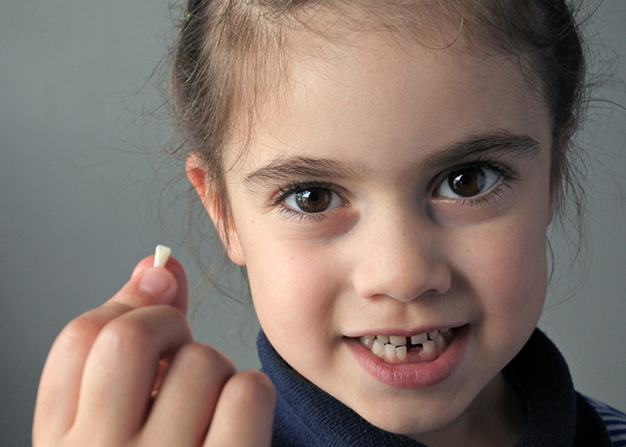 Amarillo Super Smiles For Kids | Baby Molar Crowns, Pediatric Dentistry and Extractions