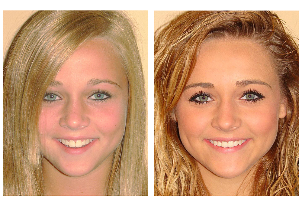 Amarillo Super Smiles For Kids